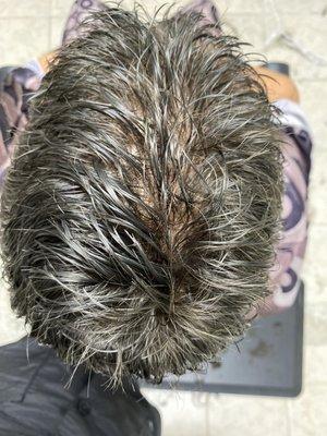 See scalp