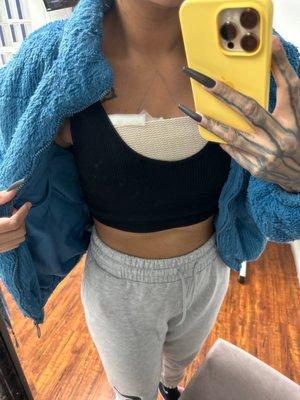 2 days post-op from a breast lift.