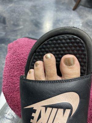 Bad pedicure