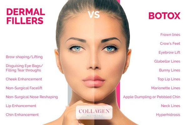 Describing fillers and Botox