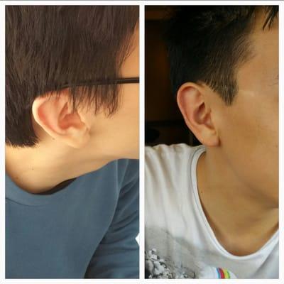 Before and after, around the ears