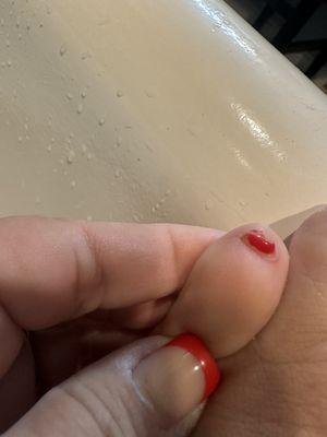 Little toe