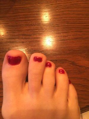 There is no way someone professionally trained and licensed did this pedicure.