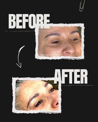 Permanent eyeliner before and after