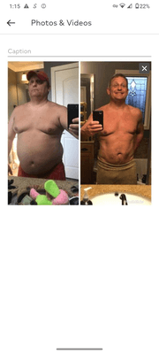 Before And After Craig Eberle (down 80 pounds)