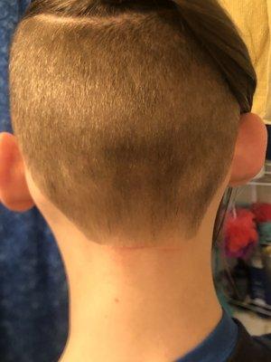 Son's undershavr and the cuts along the hairline.