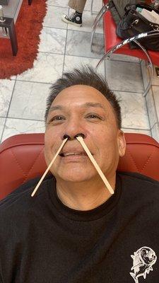 Nostril hot wax treatment