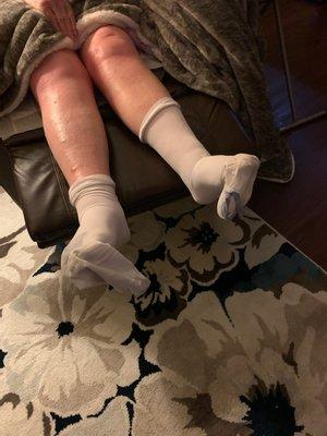 This is how Asbury Court in Des Plaines put my mom support hose on her extremely painful edema legs.