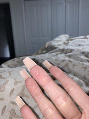 Bottom of finger also cut