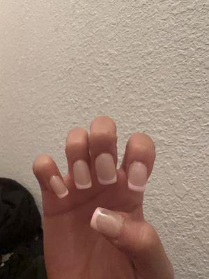 horrible nails