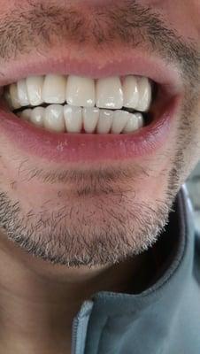 Awesome dentistry from a true artisan of the pearly whites