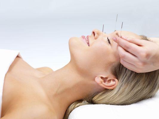 Facial Acupuncture , Natural Anti-aging
 cosmetic acupuncture