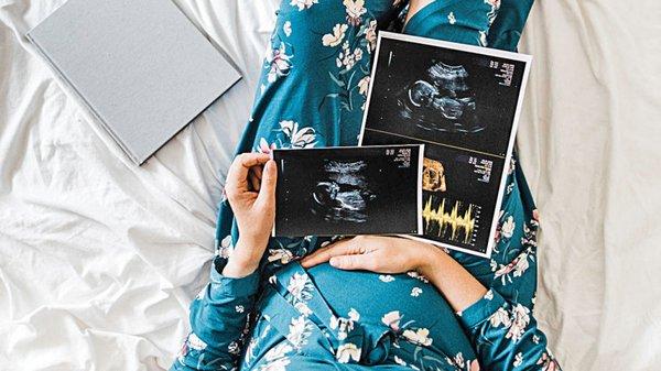 Early Gender Reveal Ultrasounds starting at 13 weeks