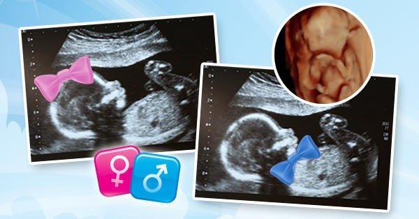 Gender determination ultrasound starting at just 14 weeks pregnancy.