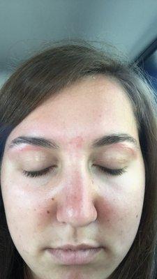 Went and got my eyebrows waxed with Sarah at this FS, came out with what seems to be a burn or cut of somesort.