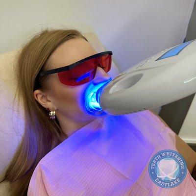 LED Teeth Whitening in progress at Eastlake Teeth Whitening in Chula Vista. The best Teeth Whitening Service in San Diego!