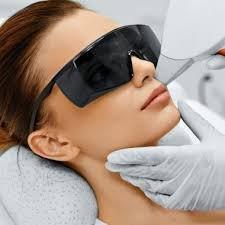 LightSheer Diode Laser Hair Removal on the facial areas; including lip, chin, sideburns and neck.