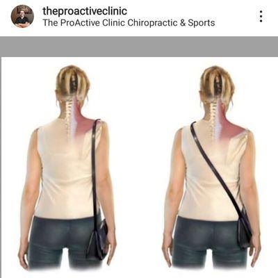 Carrying a purse on the shoulder throws off your entire spine, even if it's empty. It also requires constant contraction of you shoulder.