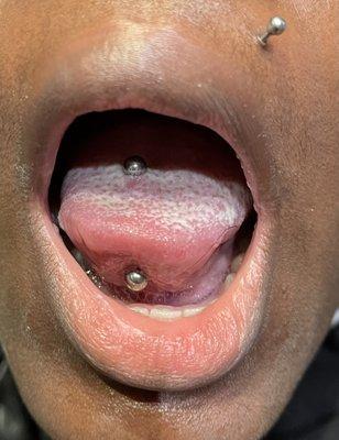 Tongue piercing