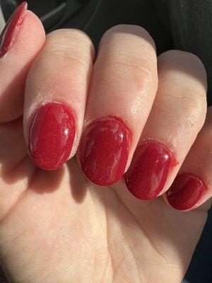 Bloody nail beds