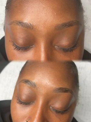 Brow shaping