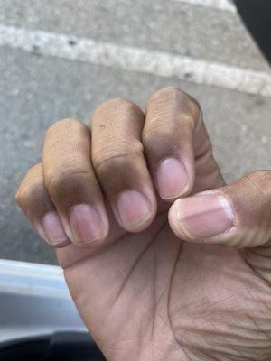 Horrible manicure