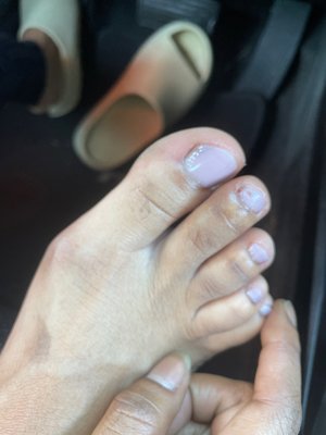 Toe callus still prominent after pedicure ,nail polished chipped from cuticle oil after being made aware.