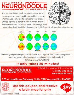 Get a Brain Map Now only $99