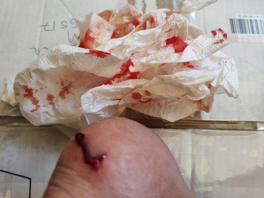 Screen door slammed on my heel from sharp edge with no guard or air cylinder to prevent quick shutting . I sustained a flap laceration .