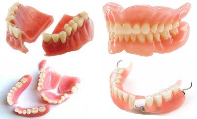 Same Day Denture Repair $125-$160