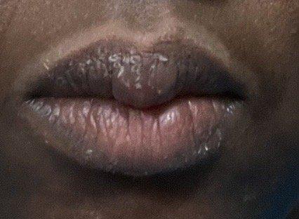 This is how my lips looked initially.