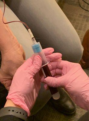 Drawing blood for PRP (platelet rich plasma) injection. Stem cells.