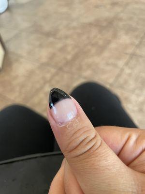 Messed up nail