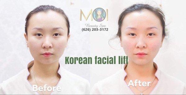 MOI Beauty Spa - beauty spa in El Monte CA 91732