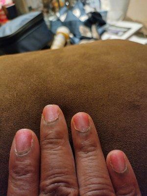 Dry, rough nails