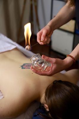 Fire Cupping