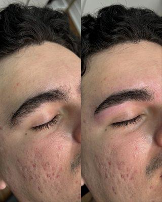 Before and after men's natural brow shaping