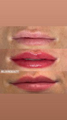 Lip blush before after healed