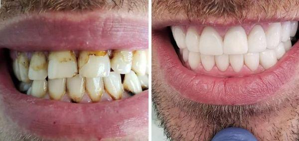 We have over 10 years experience dealing with major reconstructive cosmetic dentistry.