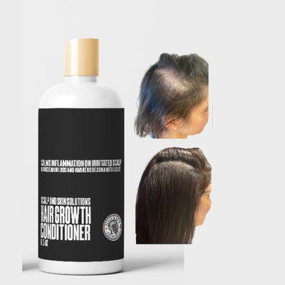 Hair Growth Shampoo
 #1scalptreatmentchicag#hairgrowthsalon