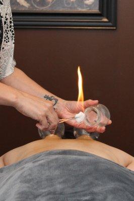 Cupping treatment. It doesn't hurt, we promise.