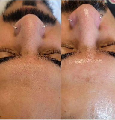 Custom gentleman's facial