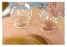 Cupping