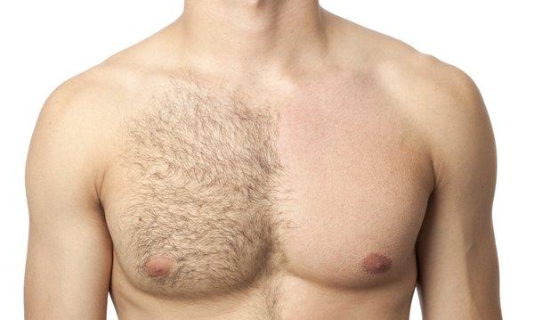 Chest wax before and after.