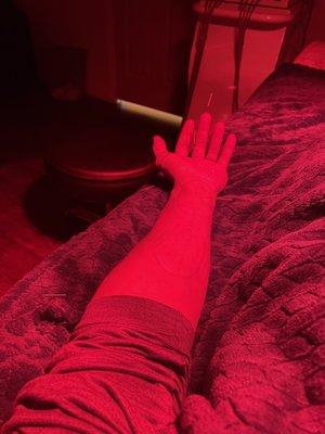 Acupuncture with red light treatment does a body good!