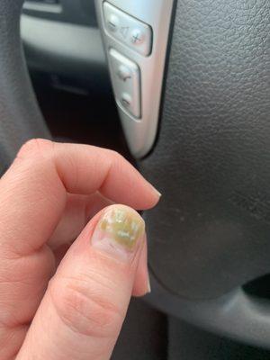 Disgusting nail fungus-their equipment is dirty!!!