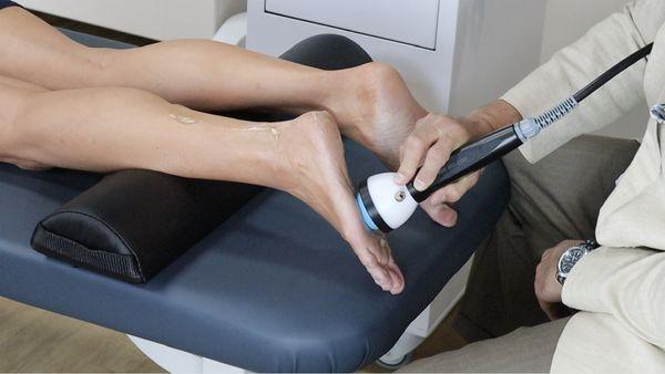 Stemwave for Plantar Fasciitis, peripheral neuropathy and more