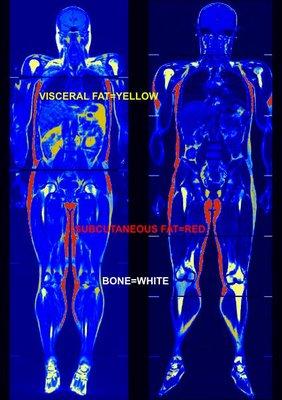 Holland Clinic offers state of the art DEXA scanning through Body Math