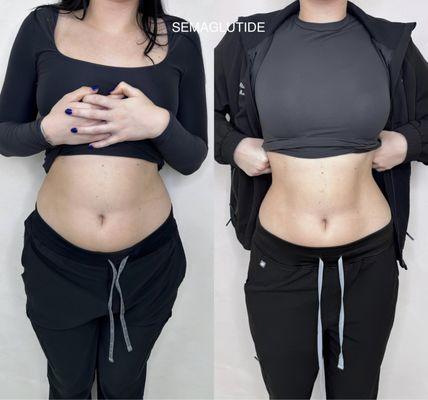 Galore Medical Weight Loss Program