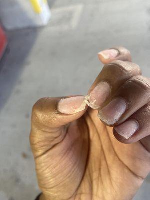 My real nail is split in three different parts on this finger.